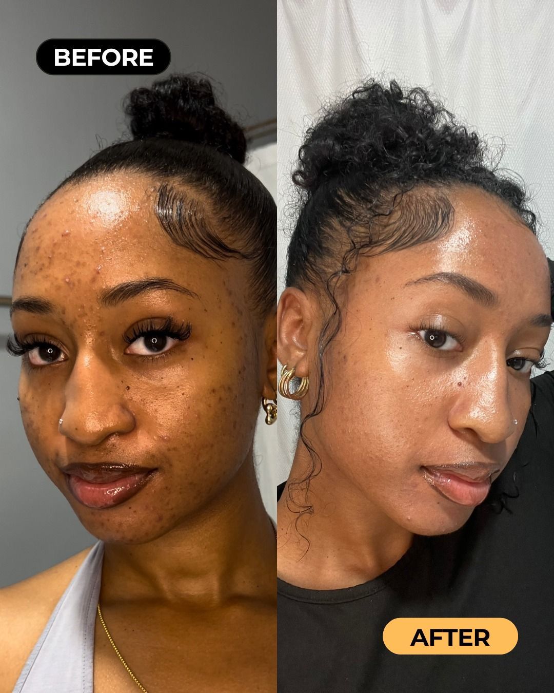 Samantha M. before and after using Medicube PDRN Pink Collagen Balm Stick